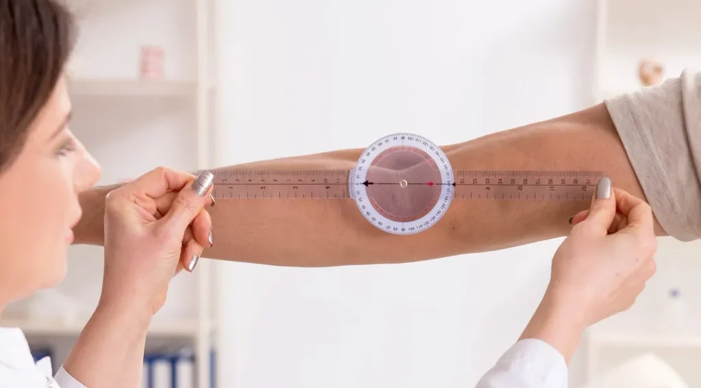Ellbogenschmerzen außen: Tennisarm oder etwas anderes? | Ortho-Hart